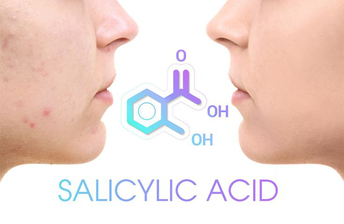 AXIT SALICYLIC – BHA (beta hydroxy acid)
