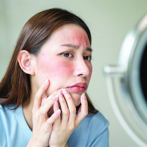 ROUTINE DA MẤT CÂN BẰNG, MỎNG YẾU